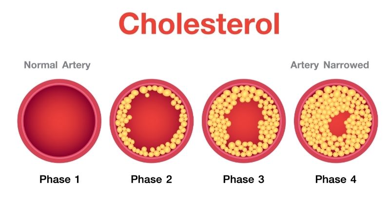 integratori per colesterolo